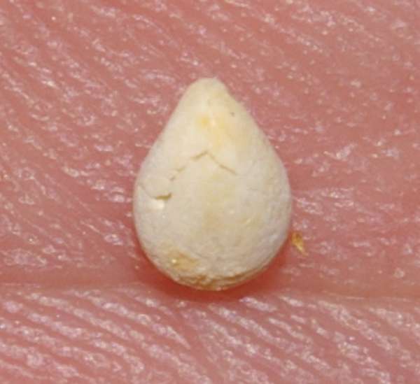 Terebratula carnea var elongata
