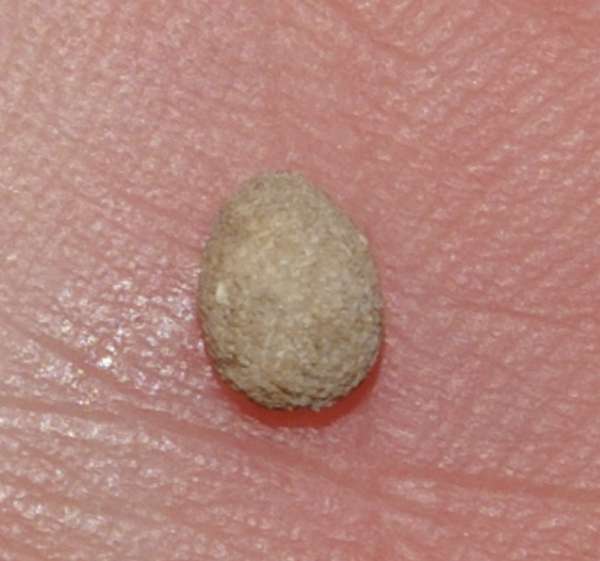 Echinocyamus parvus