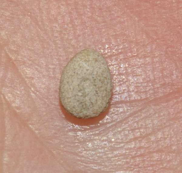 Echinocyamus parvus